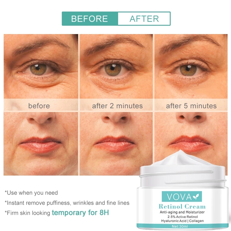 VOVA eye cream 30mlRetinol Face Cream Eye Cream Serum Set Lifting Anti Aging Anti Eye Bags Remove Wrinkles Moisturizer Facial