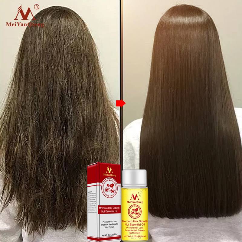 Herbal Nut Hair Care Essence Oil Repair Hair Damage Accelerate Growth Prevent Hair Loss Hair Care Products 20ml