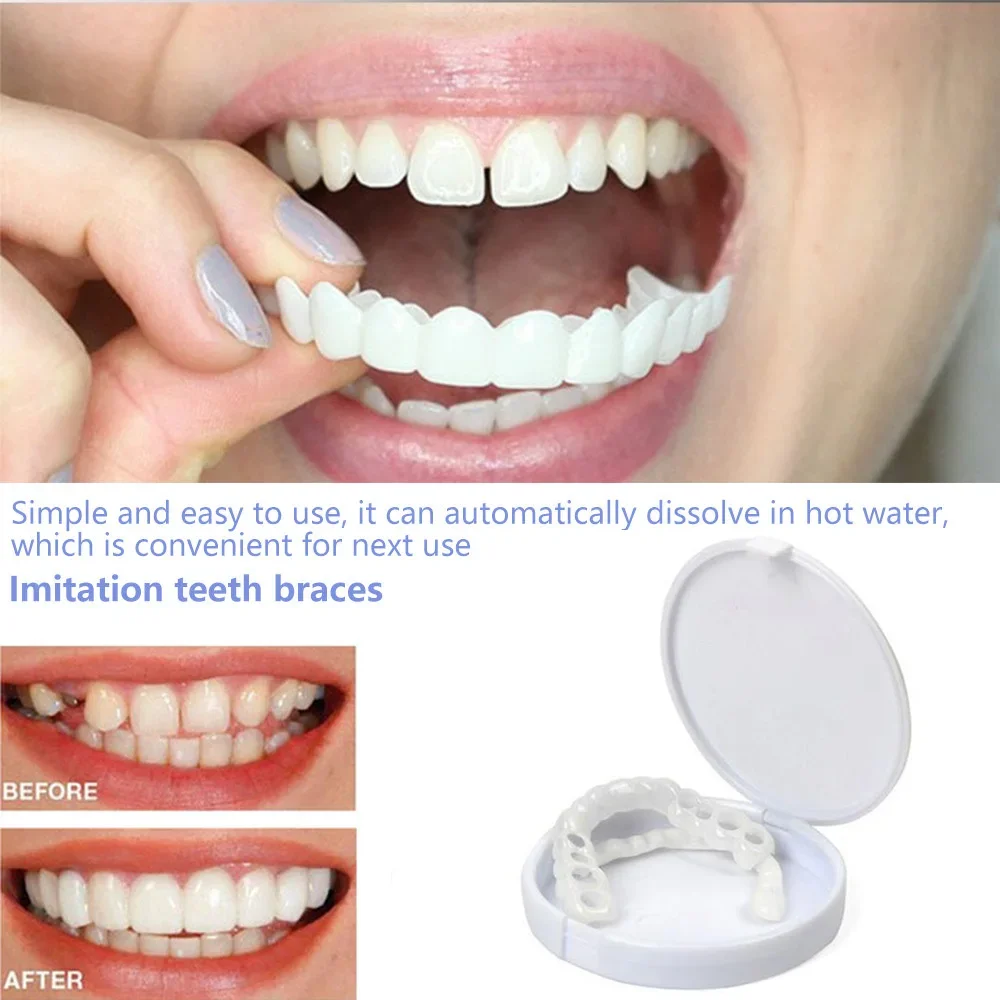 Sdottor Fake Teeth Artificial Braces Teeth Whitening Snap On Silicone Smile Veneers Upper & Lower Teeth Brace Cover Dental Beau