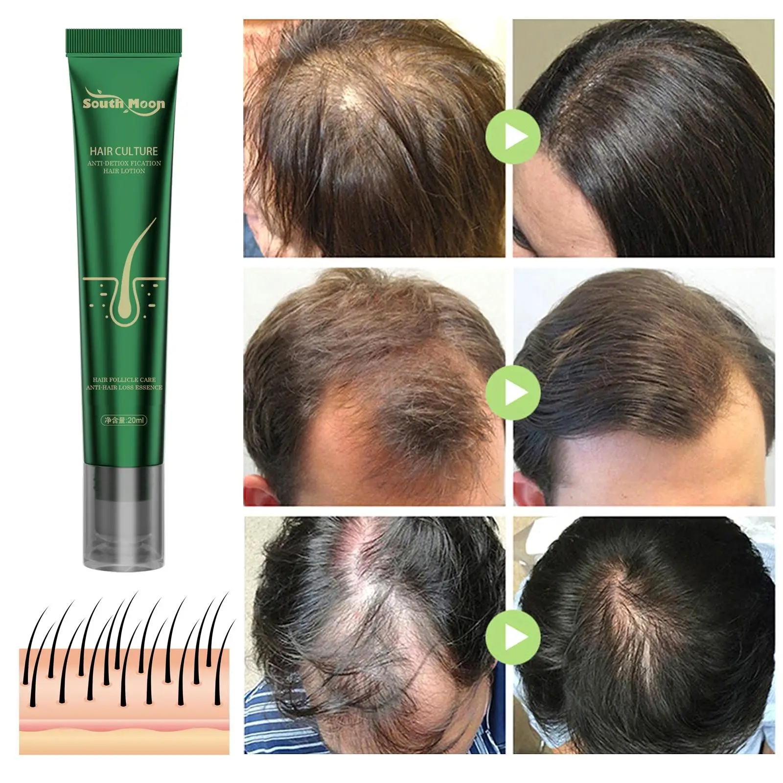 1PC Biotin Fast Oil Hair Regrowth Serum Hair Thinning Treatment Liquid Anti-Hair Loss For Women & Men