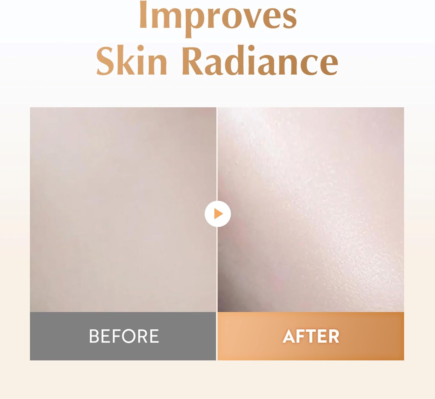 UIQ Biome Barrier Treatment Essence Nourishing, Hydrating, Moisturizing Toner l Korean Skincare for All Skin Types | Daily Gentle Dead Skin Cell Care