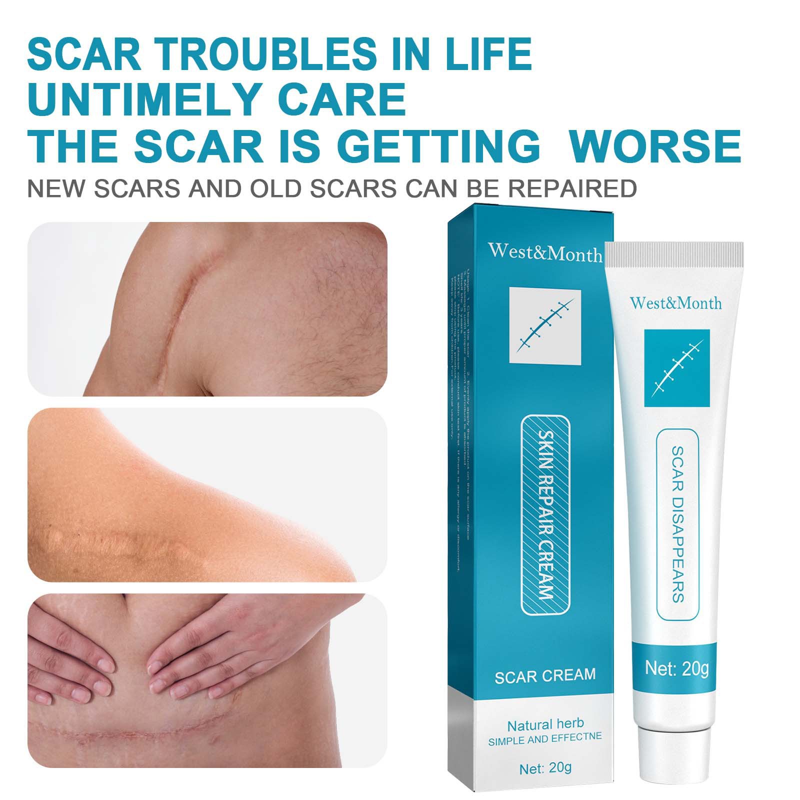 Herbal Scar Removal Cream Gel Stretch Marks Remove Acne Spots Burn Surgical Scars Treatment Smooth Whitening Face Body Skin Care