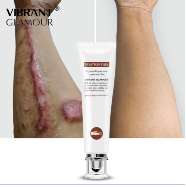 VIBRANT GLAMOUR Repair Scar cream Removal Acne Scars Stretch Marks CreamSurgical scar Burn For Body Pigmentation Corrector care