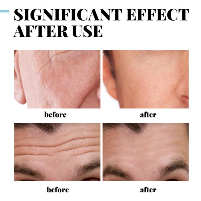 30g Men Anti Aging Face Cream Deep Moisturizing Oil Controlling Wrinkle Skin Day Firming Anti Care Cream