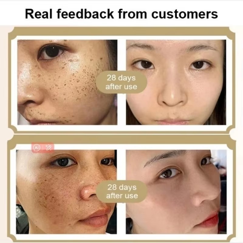 Astragalus Whitening Freckles Cream Face Dark Spots Remover Repair Products Removal Melasma Melanin Moisturiz Brighten Skin Care