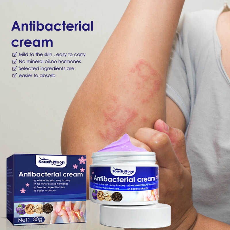 Psoriasis Dermatitis Eczematoid Eczema Ointment Anti-Itch Chinese Herb Medical Skin Care Cream