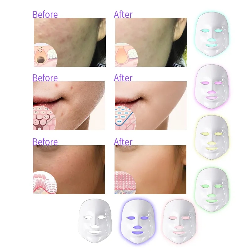 7 Colors Led Facial Mask Led Photon Therapy Face Mask Machine Light Whitening Skin Care Anti Acne Removal Mask Beauty Led Mask
