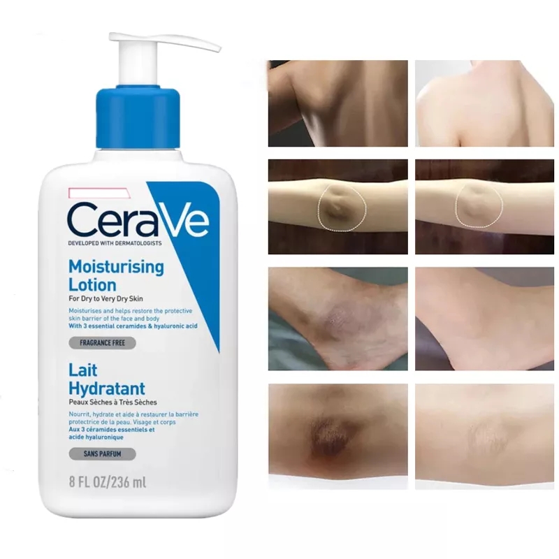 CeraVe Moisturizing Lotion for Dry Skin Body & Facial Moisturizer with Hyaluronic Acid and Ceramides Daily Body Cream Products