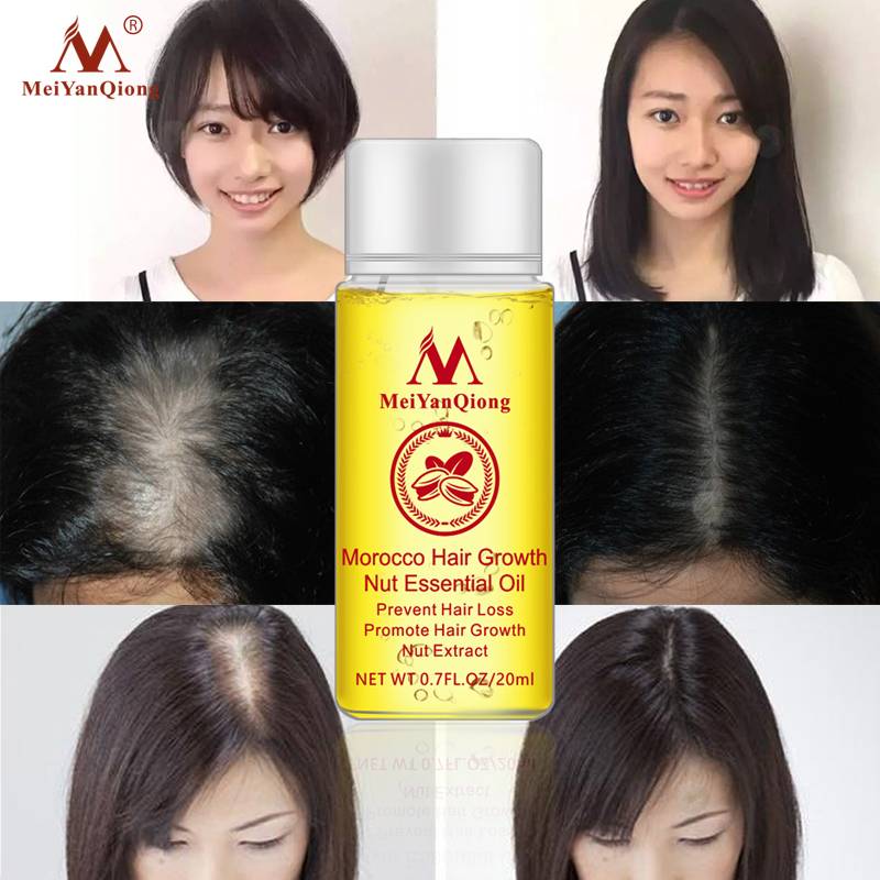 Herbal Nut Hair Care Essence Oil Repair Hair Damage Accelerate Growth Prevent Hair Loss Hair Care Products 20ml