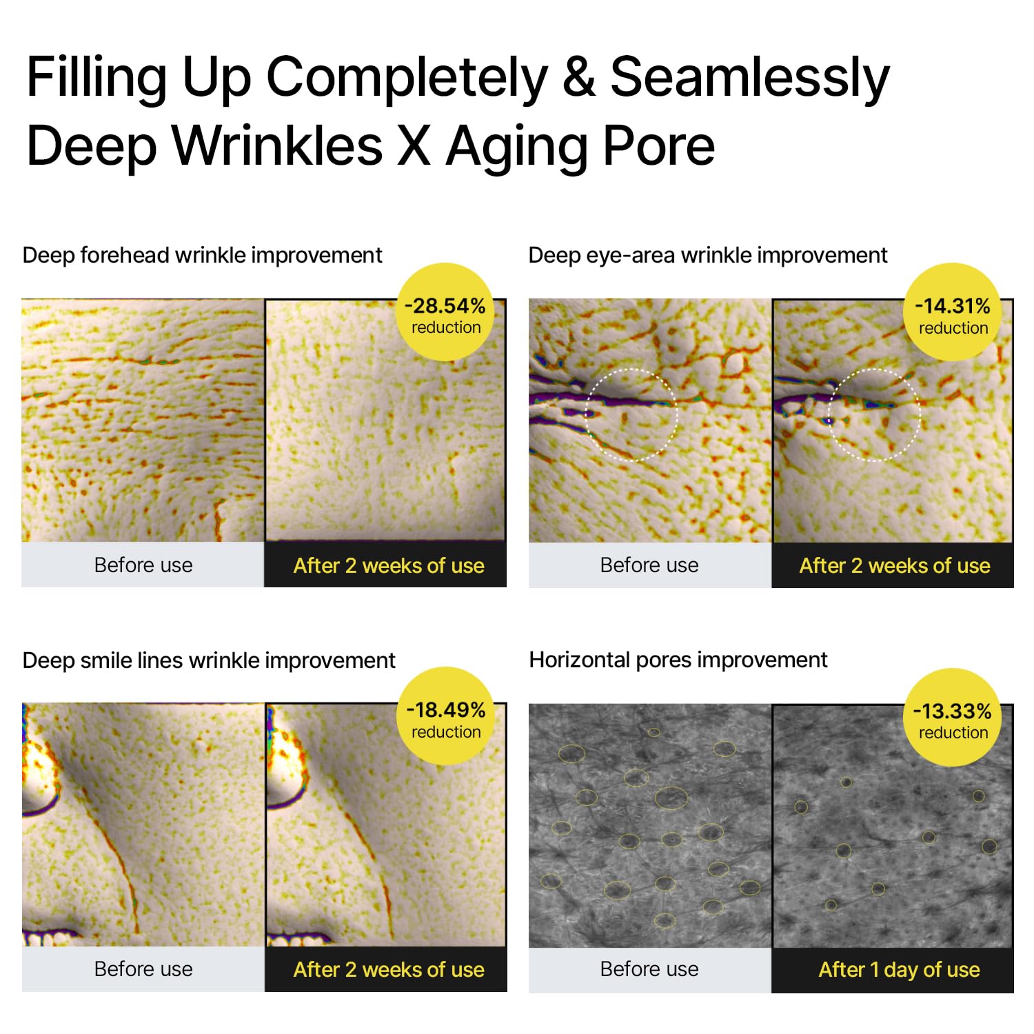 celimax The Vita A Retinal Shot Tightening Booster | 0.1% Retinal, 3% Matryxyl, High-Strength Retinoid for Anti-Aging, Pore Minimizer, Wrinkles & Fine
