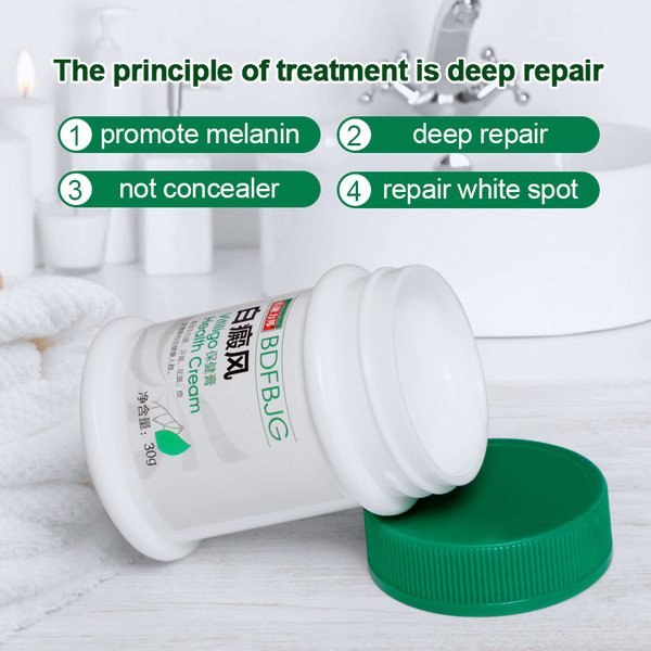 30G Vitiligo cream Antibacterial cream Psoriasis Localised Vitiligo Zalf White spot Mycosis Leucoplasia Treatment P1153