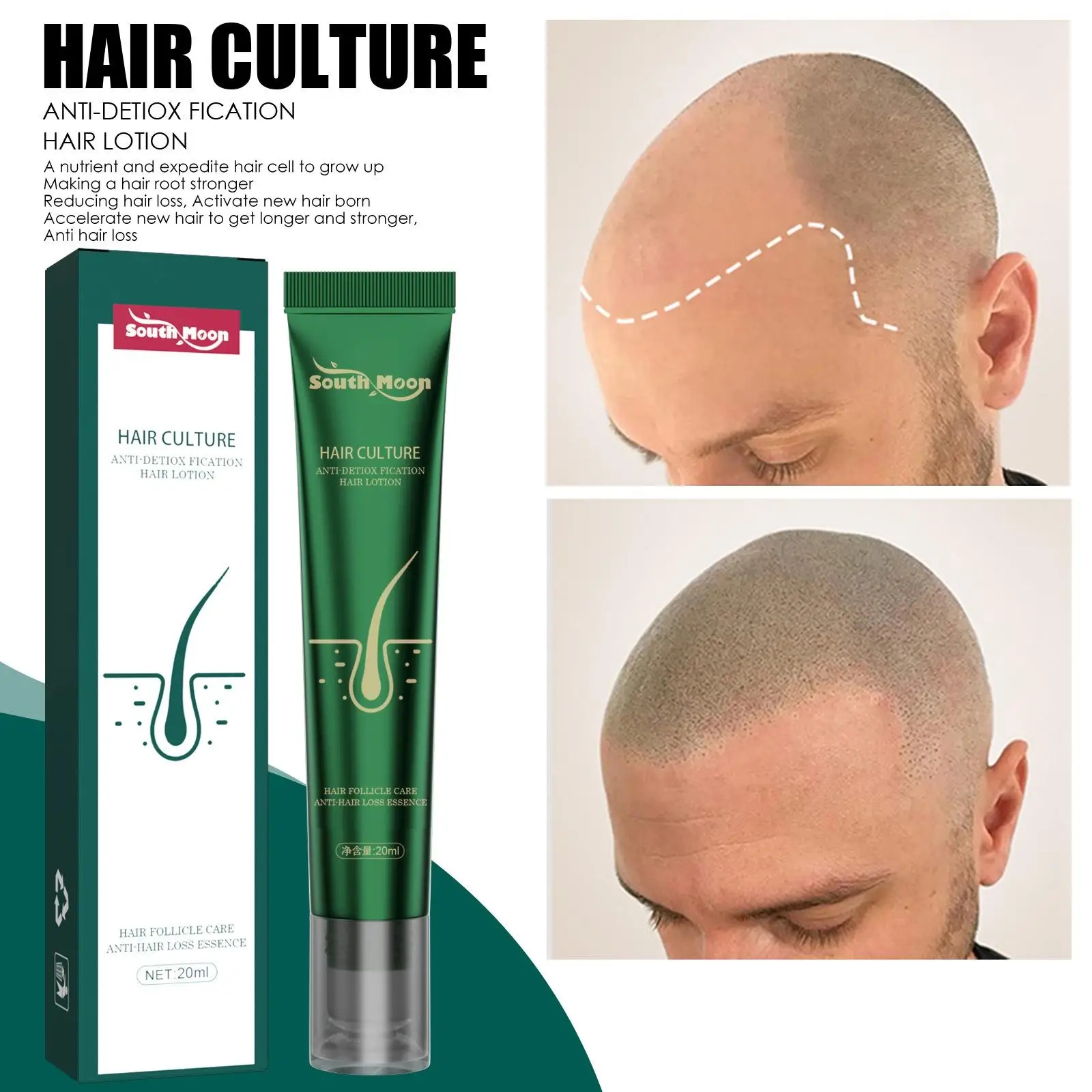 1PC Biotin Fast Oil Hair Regrowth Serum Hair Thinning Treatment Liquid Anti-Hair Loss For Women & Men
