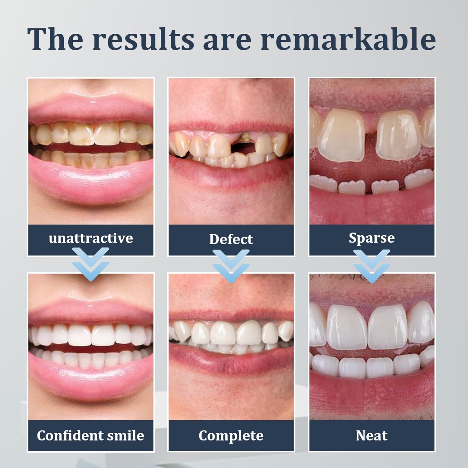 2 Pairs Temporary Smile Veneers, Adjustable Comfortable Fit for Men and Women (Bright White3)