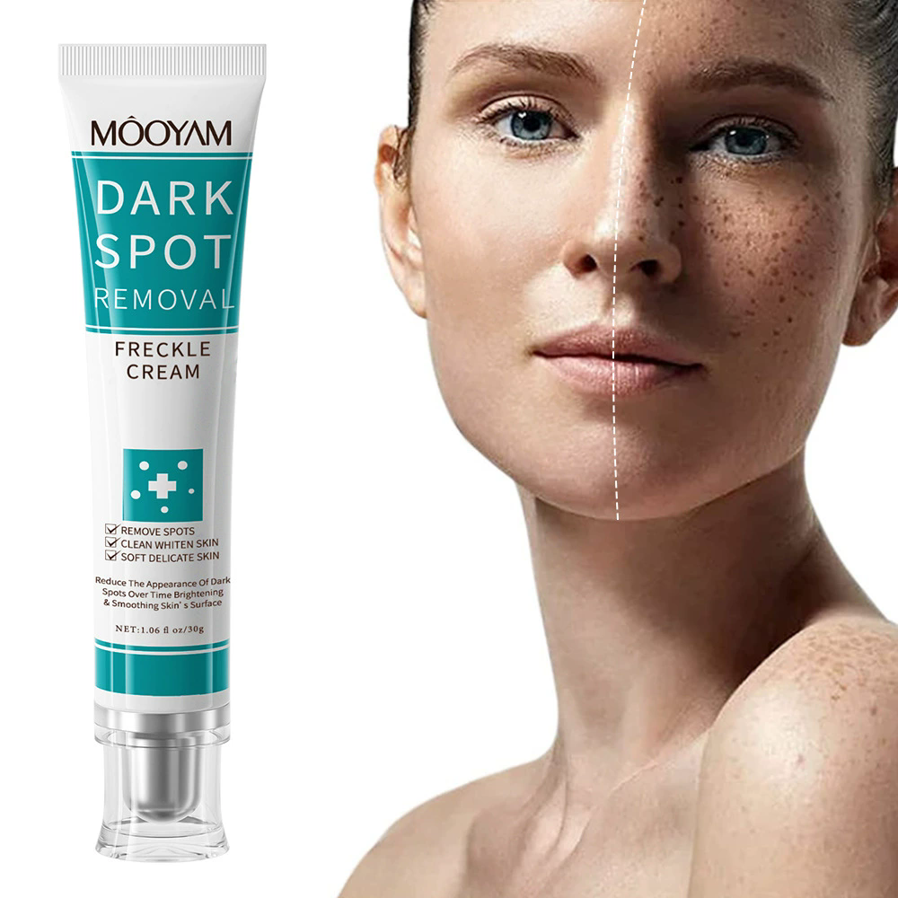 1PC DARK SPOT REMOVAL CREAM WHITENING FRECKLE CREAM