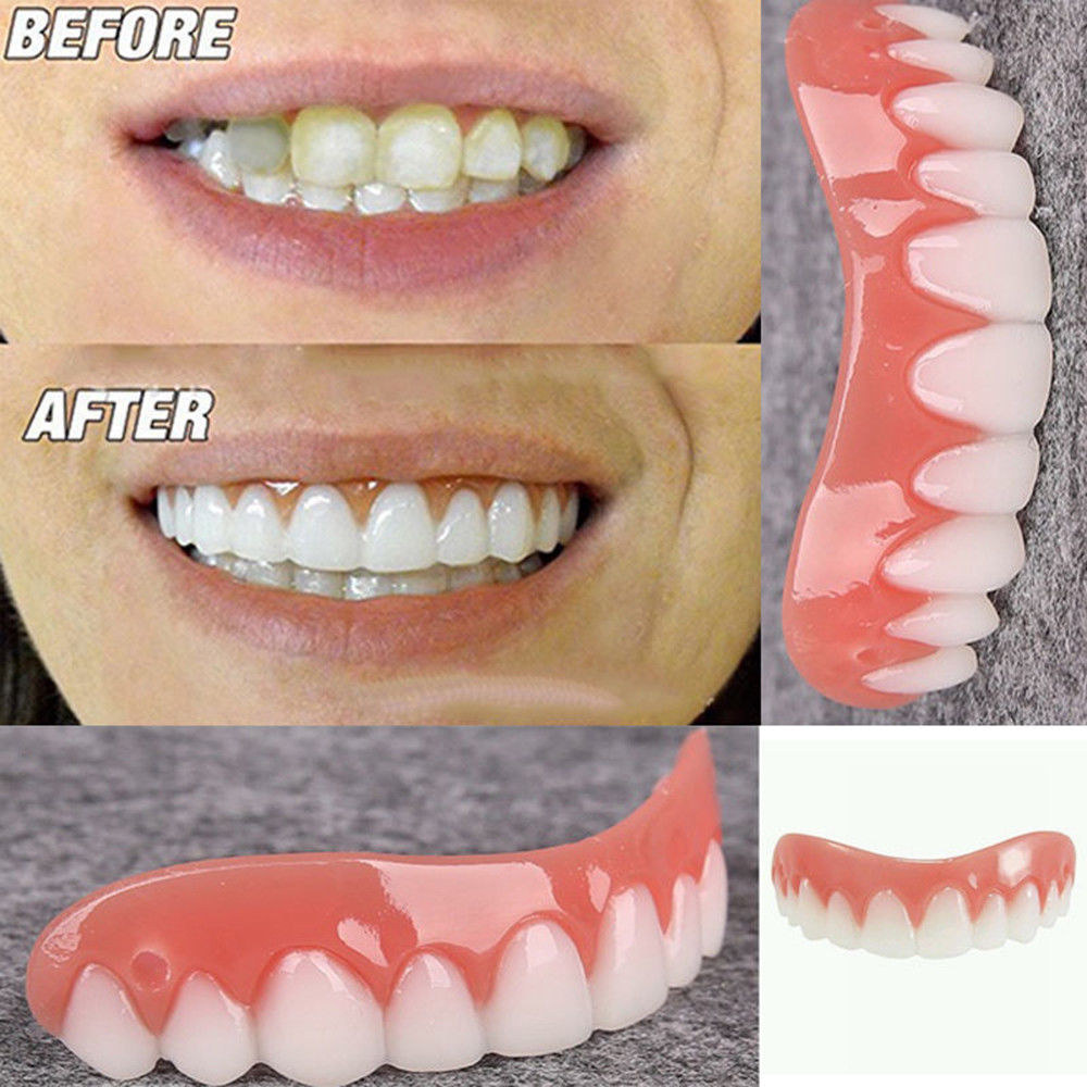 Silicone Simulation Teeth Veneer Smile Perfect Snap Denture Veneer Cosmetic Teeth Cover Whitening Braces