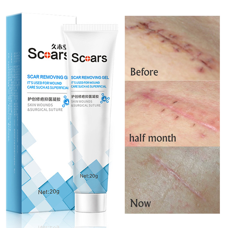 Herbal Scar Removal Cream Gel Repairing Pock Mark Burn Surgical Scar Cesarean Scar Stretch Marks Smooth Moisturizing Skin Care
