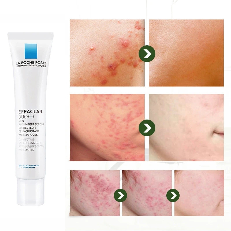 La Roche Posay Effaclar Duo (+) Acne Pimple Remover/Acne Spot Treatment Acne Scar Marks Remover Repair Whitening Skin Care 40ml