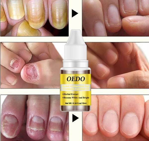 OEDO effective natural oil nail polish liquid repair treatment nail toe fungus removal moisturizing nail foot care essential oil