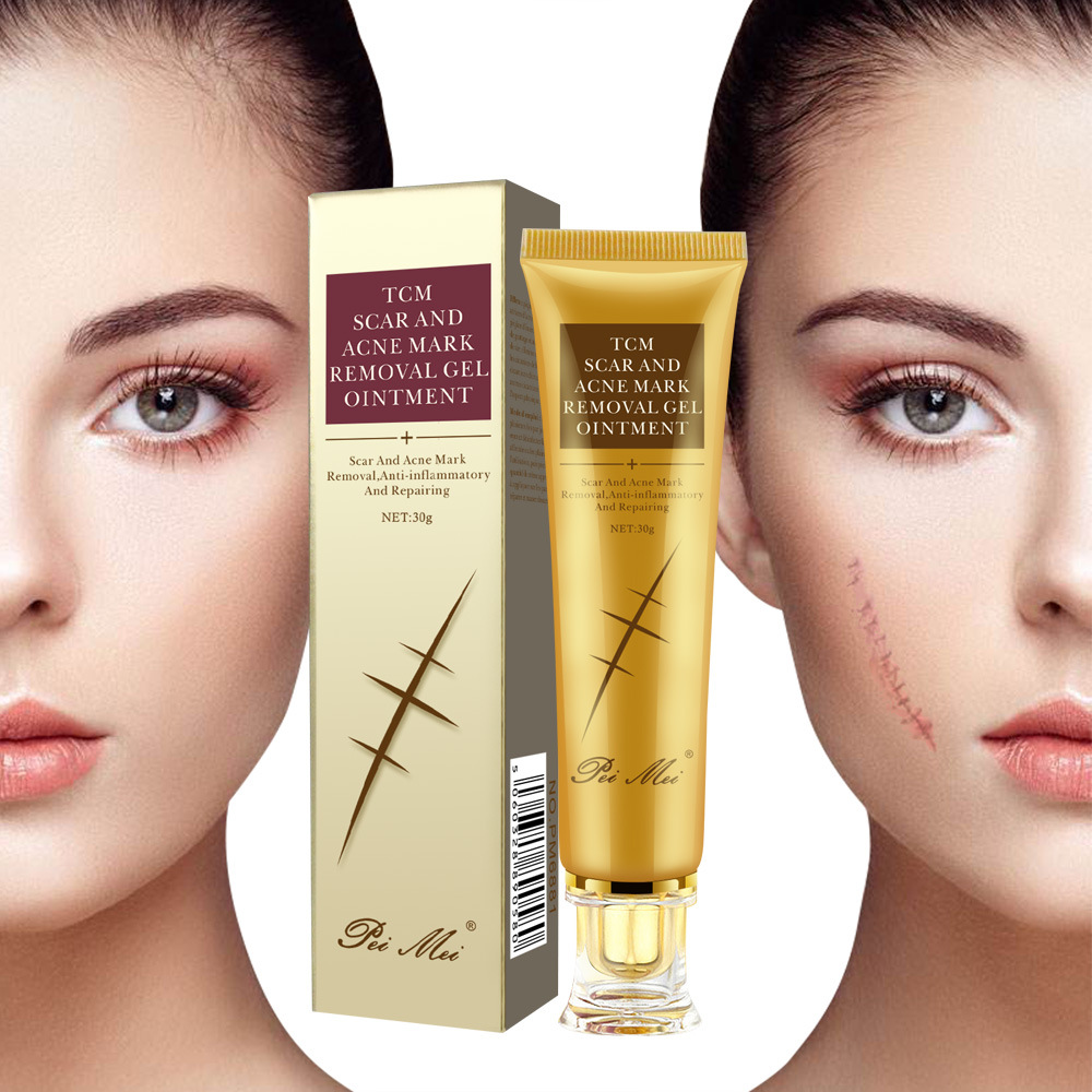 30g Acne Scar Removal Cream Gel Face Pimple Stretch Marks Repairing Cream Smoothing Whitening Moisturizing Skin Care Body Cream