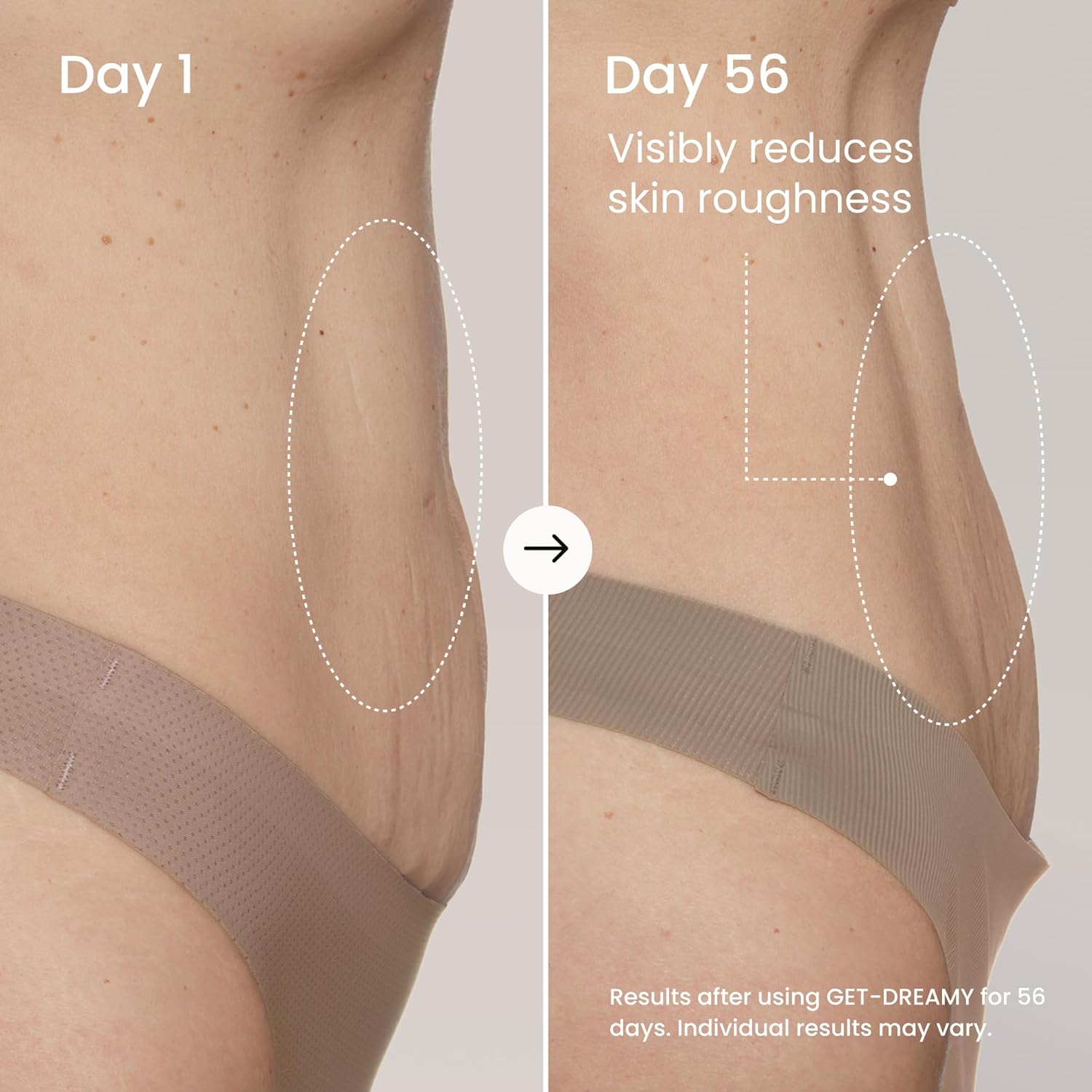 MAËLYS GET-DREAMY Overnight Toning Whip - Cellulite Cream & Skin Tightening Support with Milk Thistle + Uva-Ursi - Moisturizing Body Cream in a Whippe