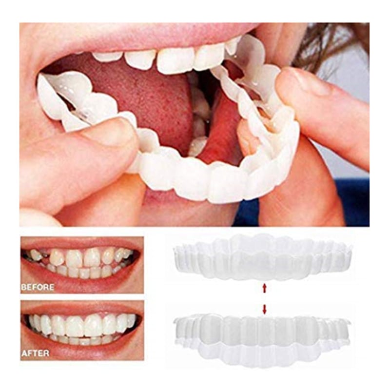 1PairThe Upper and Lower Veneer Teeth Whitening Denture Whitening Kit Is Currently Only Available for and Direct Sales