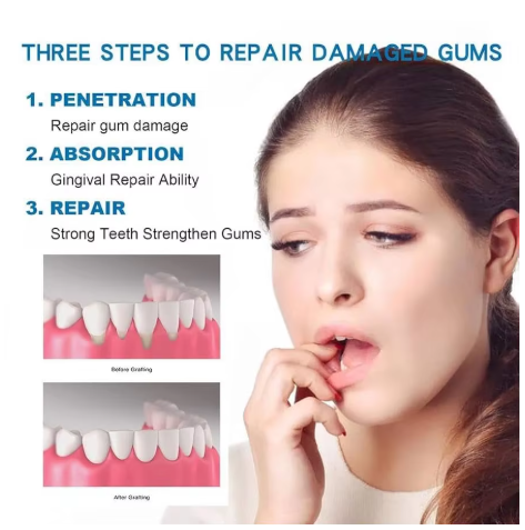 Rapid Repair Gums Gel Effectively Relieve Tooth Allergy Dental Caries Tooth Cleaning Toothpaste Relieve Tooth Damage Serum