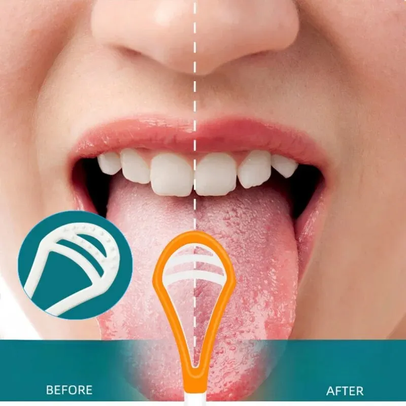 Oral Care Keep Fresh Breath Tongue Scrape Cleaner