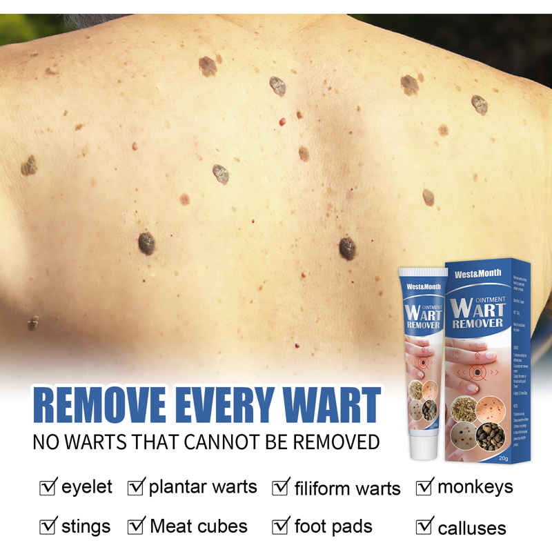 Skin Tag Remover Cream Painless Mole Skin Dark Spot Warts Remover Serum Freckle Face Wart Tag Treatment Removal Essential OIL