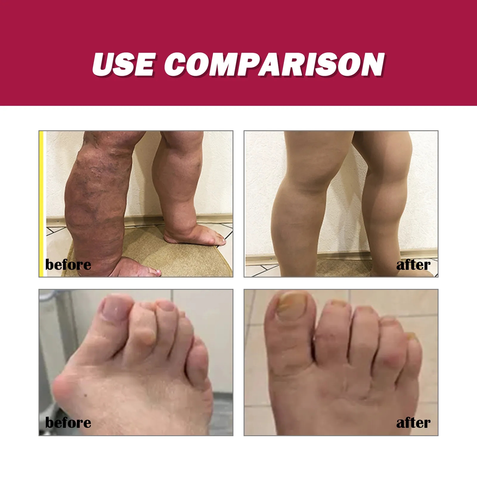 Counterpain Cream Joint Bone Pain Relief Cream Orthopedic Valgus Corrector Knee Muscle Arthritis Treatment Ointments