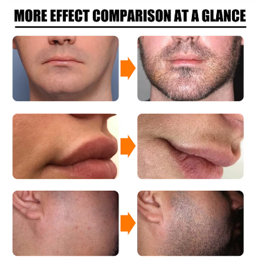 Beard Growth Oil Beard Wax Balm Hair Loss Products Leave-In Conditioner for Groomed Chest Hair Moustache Oil Beard Care 30ml