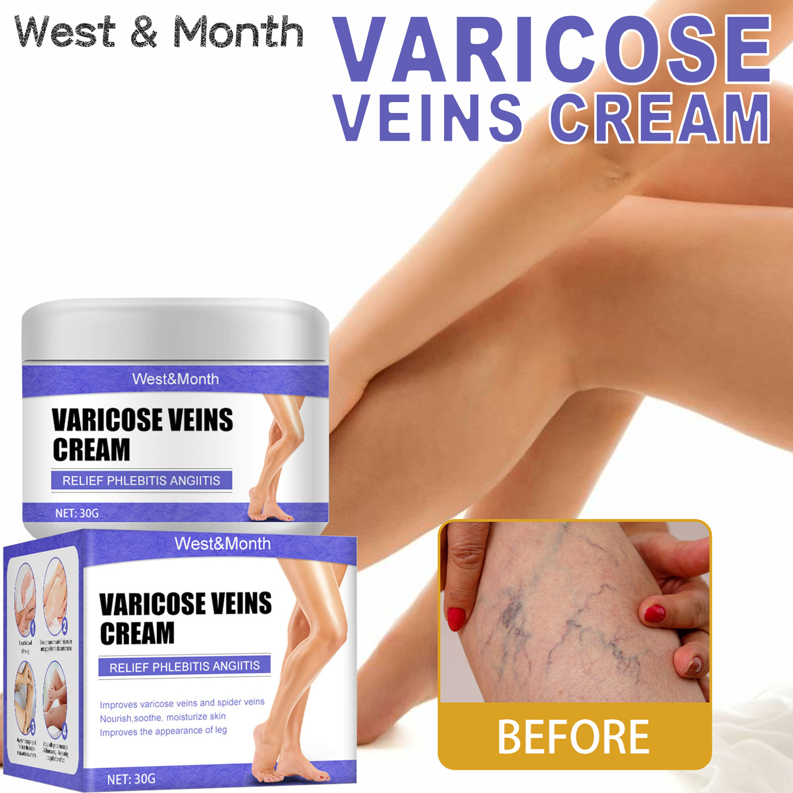 Varicose Vein Cream Earthworm Leg Vasculitis Phlebitis Spider Blue Veins Bulge Relieve Pain Red Blood Repair Moisturizing Cream