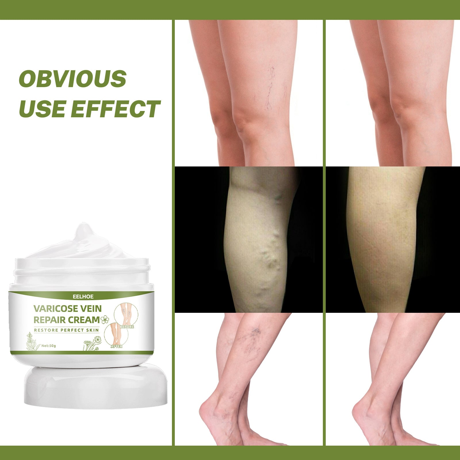 Portable Varicose Vein Repair Cream Tongmai Effective Relieves Legs Bulge Pains Treatment Cream Vasculitis Phlebitis Remove Vein