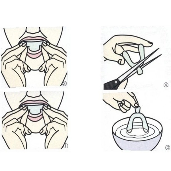1pc Anti-snoring Teeth Whitening Gel with Braces Shapeable Invisible Braces Teeth Whitening Tool