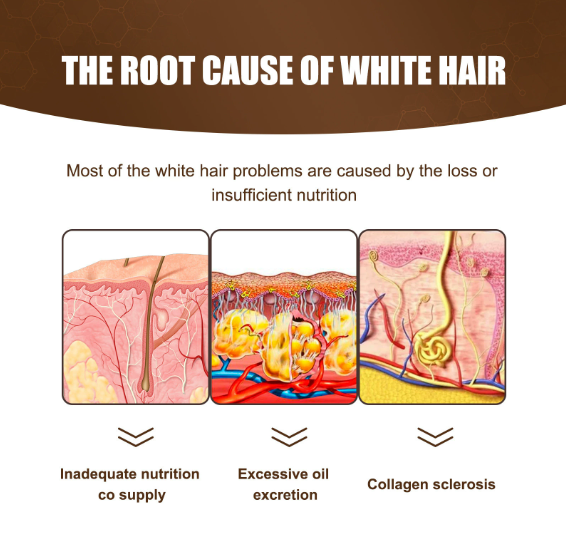 White hair Killer remove gray hair restore natural hair color