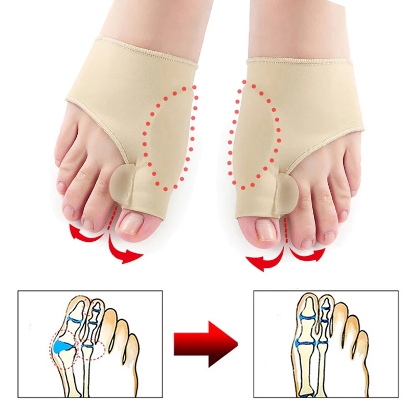 2Pcs=1Pair Toe Separator Hallux Valgus Bunion Corrector Orthotics Feet Bone Thumb Adjuster Correction Pedicure Sock Straightener
