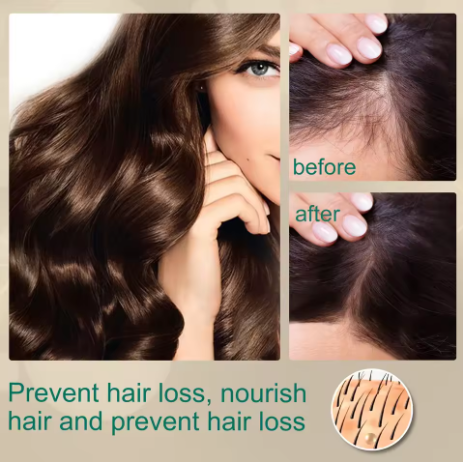 Hair Growth Products Ginger Regrowth Repair Cream Prevent Hair Loss Baldness Treatment Dense Hairs Beauty Hair Care Men Women