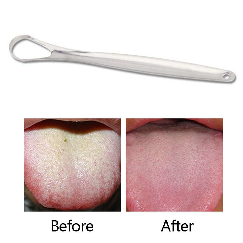 Useful Tongue Scraper Stainless Steel Oral Tongue Cleaner Medical Mouth Brush Reusable Fresh Breath Maker &
