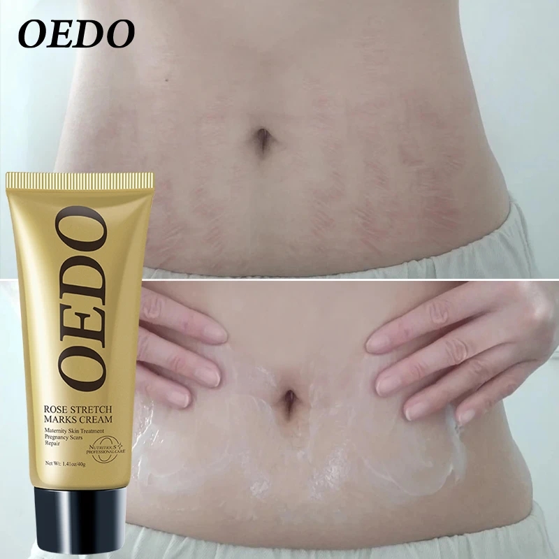 Rose Remove Stretch Marks Cream Anti Wrinkle Anti Aging Maternity Skin Repair Remove Pregnancy Scars Treatment Body Skin