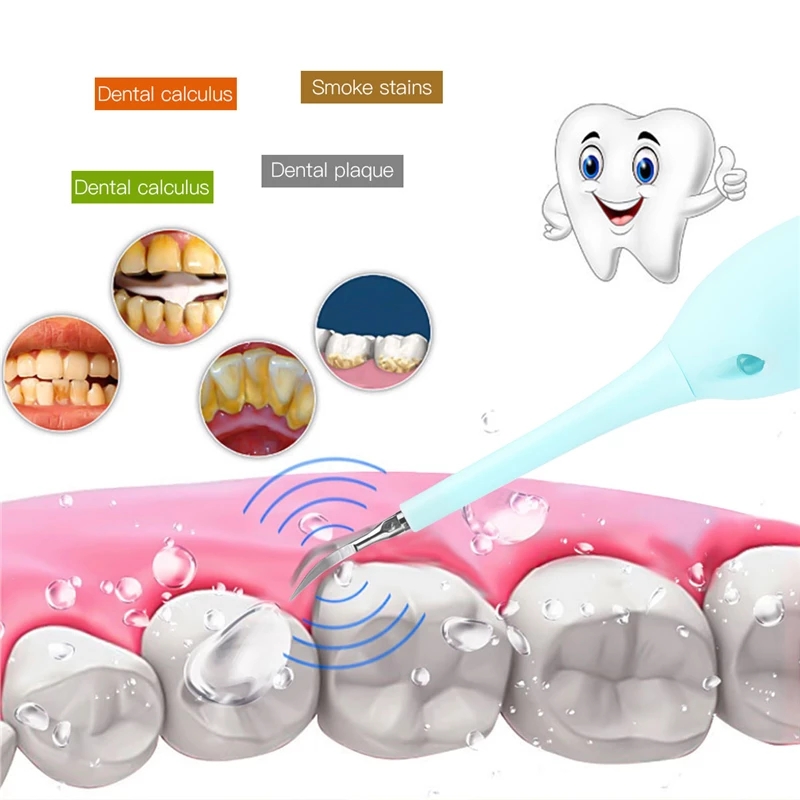 Ckeyin Portable Electric Ultrasonic Dental Scaler Tooth Calculus Tool Sonic Remover Stains Tartar Plaque Whitening Oral Cleaner
