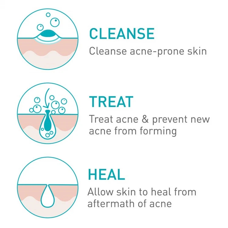 150ML CeraVe Acne Foaming Cream Cleanser 4% Benzene Peroxide for Acne and Oil Control Cream To Foam Formula Fragrance Free
