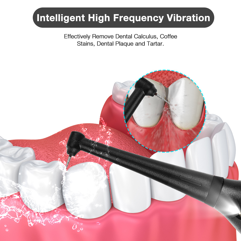 Household electric tooth cleaner tooth cleaning instrument teeth whitening care remove tartar calculus oral cleaner