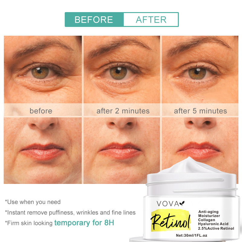 Retinol - Facial Care Cream Serum Anti-Aging Anti-Dark Circles Eliminate Wrinkles