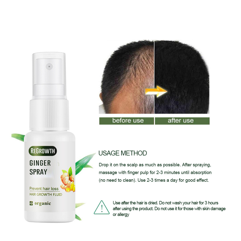 Regrowth Ginger Spray Fast Hair Growth Fluid Anti Loss Treatment Ginger Essence Prevent Hair Loss Regrowth Ginger Spray Eelhoe