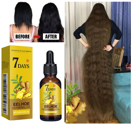 20ml Ginger Scalp and Hair Follicle Nutrient Liquid Refreshing, Moisturizing, and Strengthening Hair Care Essential Oil