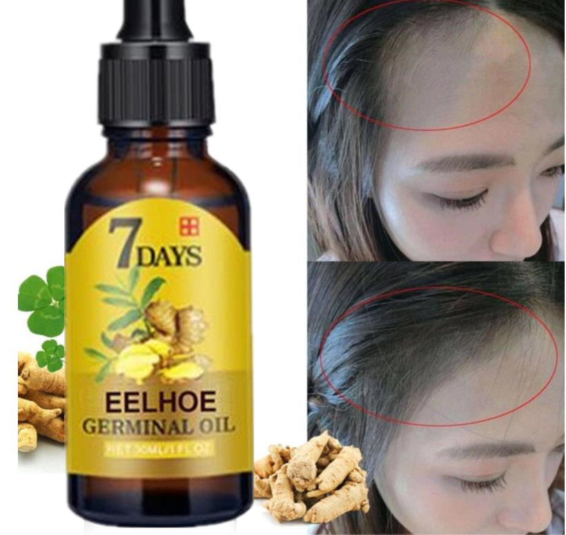 7 Day Fast Hair Growth Essential Oil Effective Hair Loss Treatment Regrowth Ginger Serum Hair Health Care Beauty
