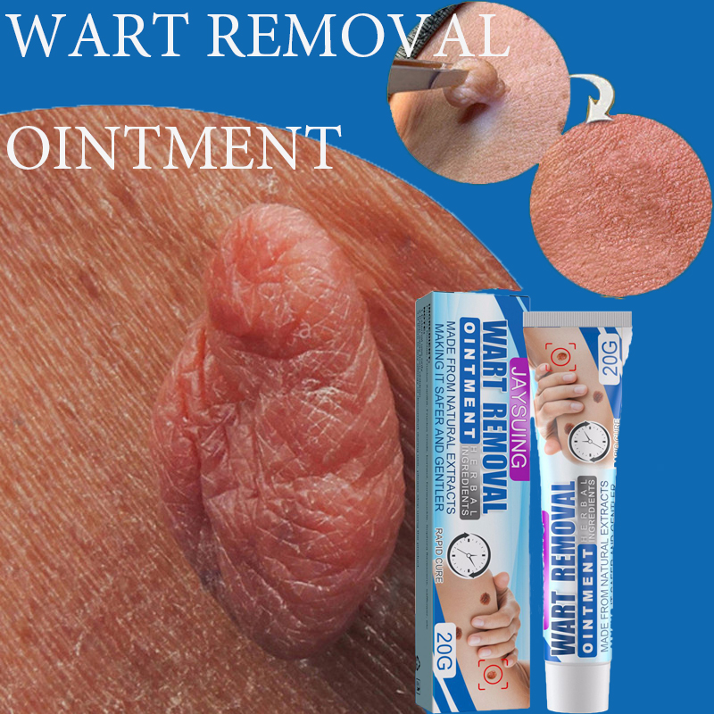 Wart Removal Treatment Antibacterial Ointment Papillomas Removing Skin Labels Flat Wart Genitals Painless Beauty Herbal Cream