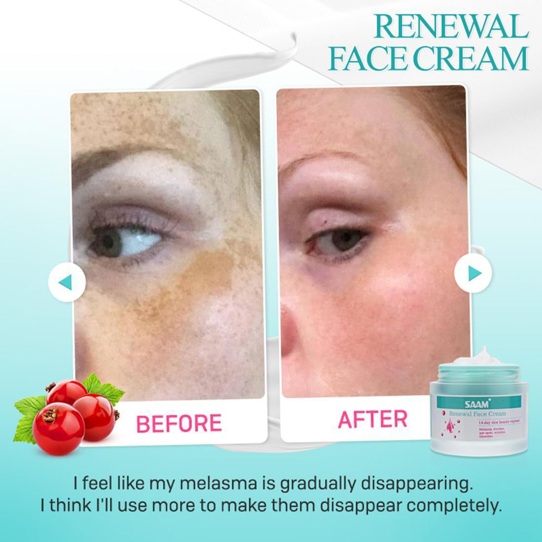 Saam Cream For Melasma Nourishing And Moisturizing Skin Face Cream Anti-Wrinkle Reduces Dark Spots And Fine Lines
