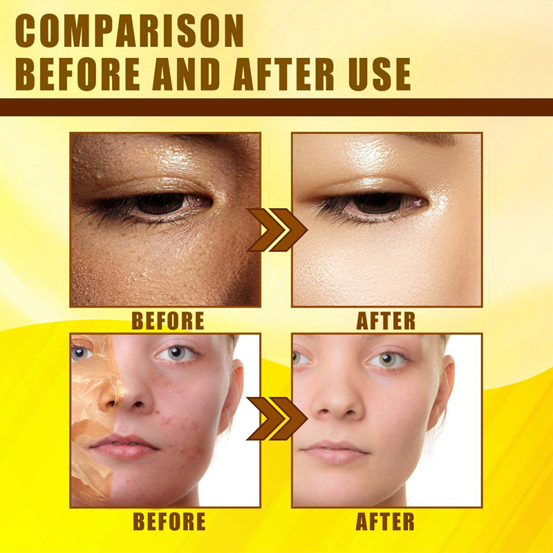 Yellow Essential Oil Moisturizes the Body's Skin, Softens and Beautifies the Skin - Moisturizing, Whitening and Brightening