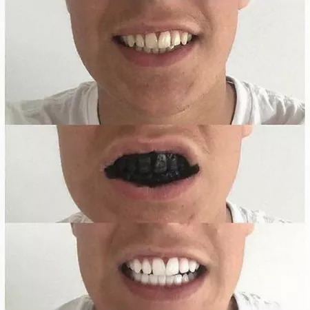 Organic Teeth Whitening Powder – Natural Charcoal Toothpaste for Brighter Smile