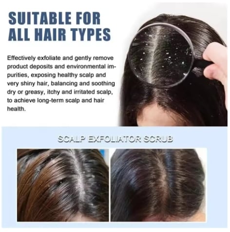 Fast Anti Dandruff Hair Oil Control Relieve Itching Treatment Scalp Cleaning Exfoliating Product Antipruritic Anti Loss Hair Car